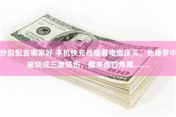 炒股配资哪家好 手机快充线插着电放床头,他睡梦中被烧成三度烧伤,醒来虎口焦黑......